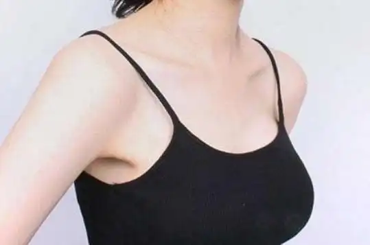 什么样的是真性胸下垂?下垂了又该肿么办?