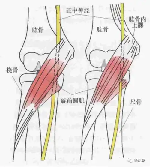 正中神经腕管综合征只靠治腕管就行了么