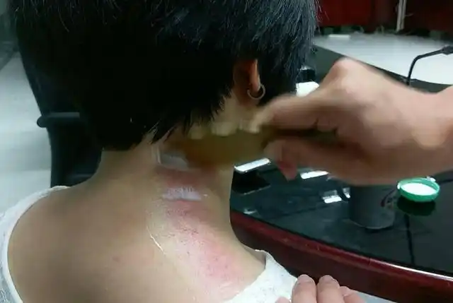 刮痧时,皮肤"越红越好"?红色意味着什么?本文或给你讲解