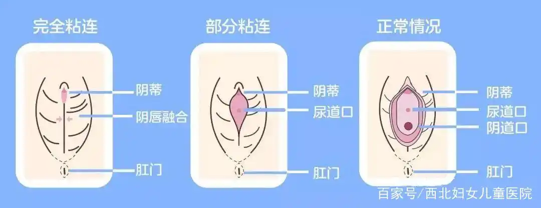 六个月女婴竟然来看妇科