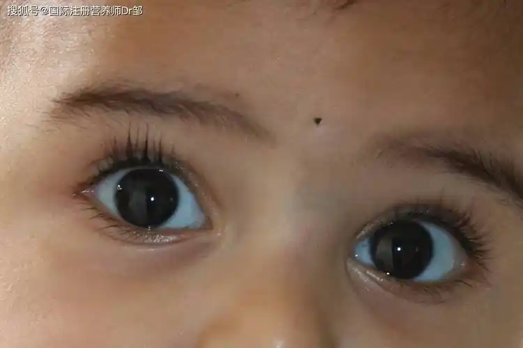 宝宝眼白发蓝,日常饮食这样优化!_功能_巩膜_蓝色