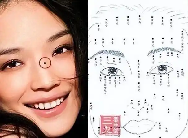 女人脸上这三个部位有痣不需要点掉!留着反而更有气质