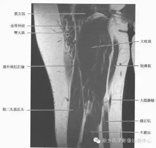来源:骨骼肌肉mri ct断层解剖(第3版)本站是提供个人知识管理的网络