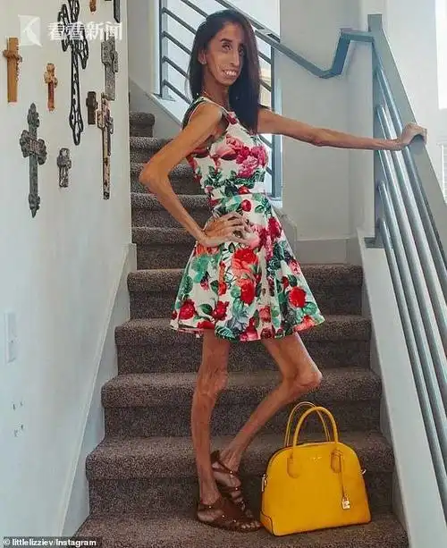 "世界最丑女子"反欺凌呼吁 求家长别在抖音上恶搞她的脸吓唬孩子