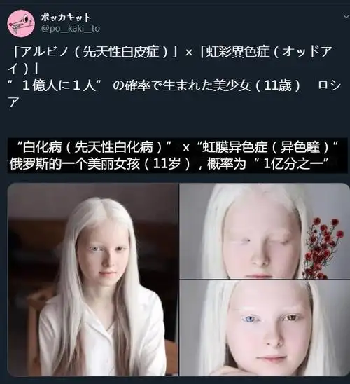 11岁美丽女孩天生白化病和异色瞳,美得像精灵,仿佛来自二次元!