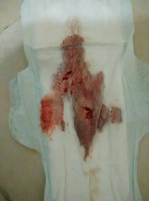 月经颜色正常米吗?