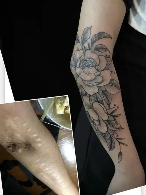 素花遮盖疤痕_纹身图案手稿图片_赵泽涵的纹身作品集