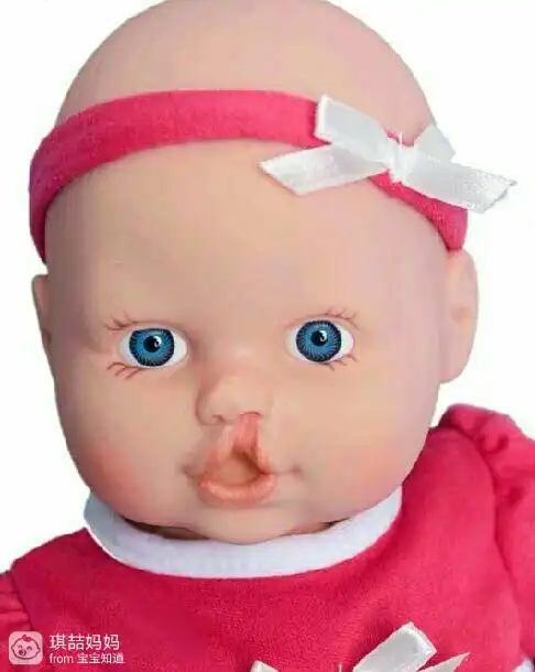 聪明的唇腭裂胎儿,为了出生拍四维彩超时用手挡住嘴巴,不让人看见!