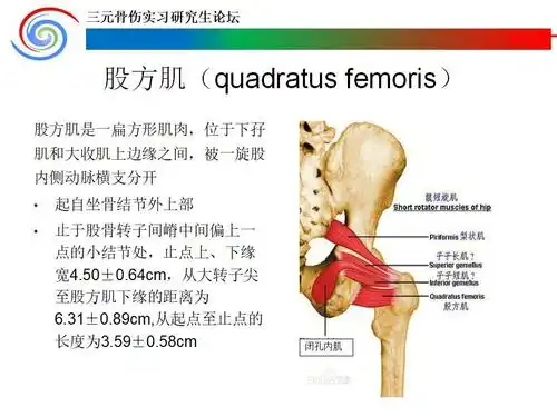 股方肌蒂骨瓣移植术治疗青壮年股骨颈骨折