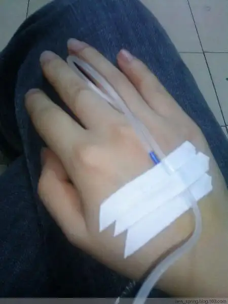 了我怕领导不批 追答: 哦,原来是这样 好,我有朋友圈女生的手打吊针