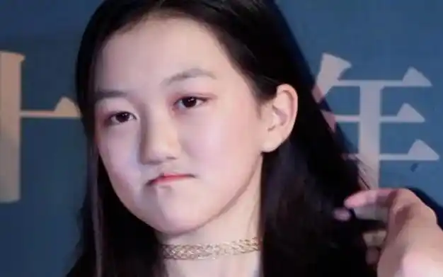 王菲花百万治疗女儿唇裂,现今唇是好了,但脸却越来越奇怪了