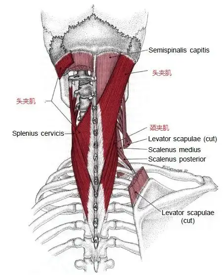 激痛点和肌肉疼痛自我按摩治疗18颈后痛