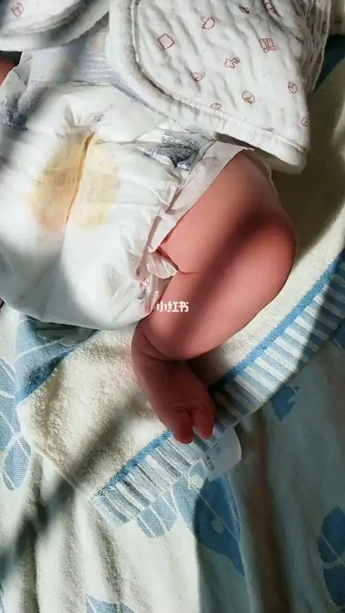 新生儿可以穿纸尿裤吗