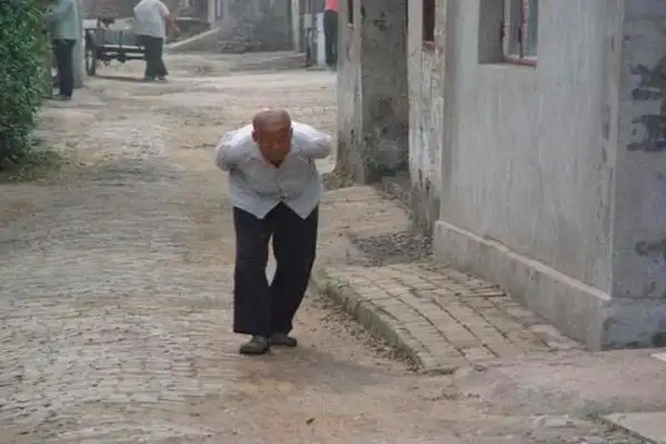 随着年龄的增加许多人都有一些驼背,就是人们常说"罗锅"