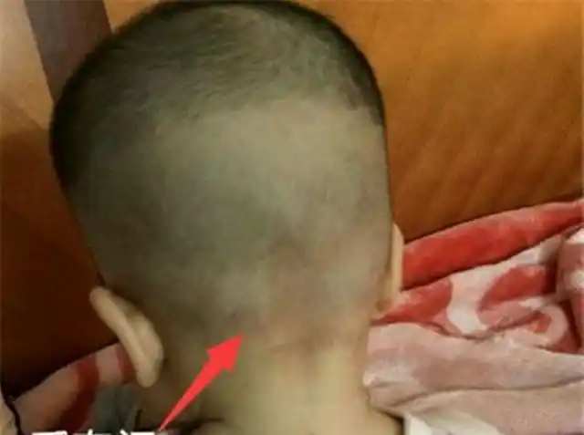 如果宝宝的囟门上有污垢,很难清洗掉,那妈妈可以将相关的油类蒸熟后