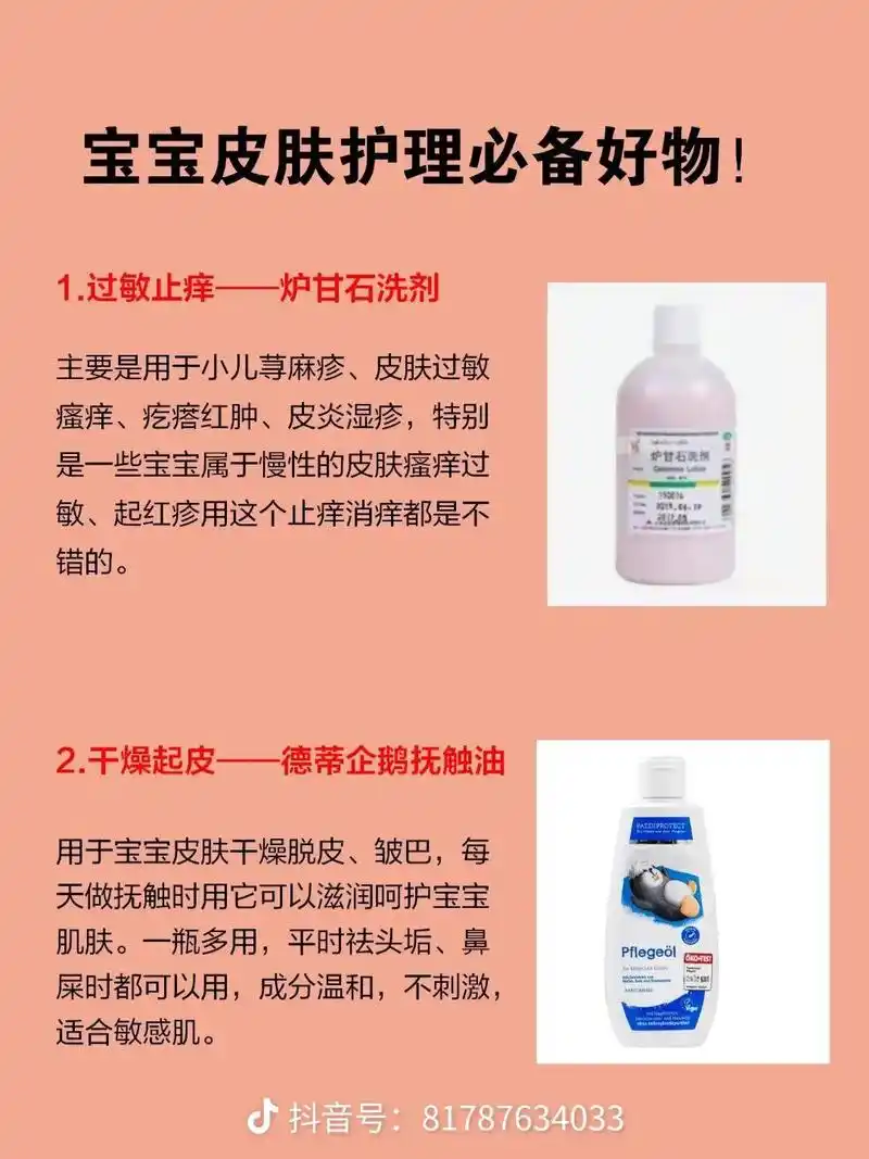 1.过敏止痒——炉甘石洗剂主要是用于小 - 抖音