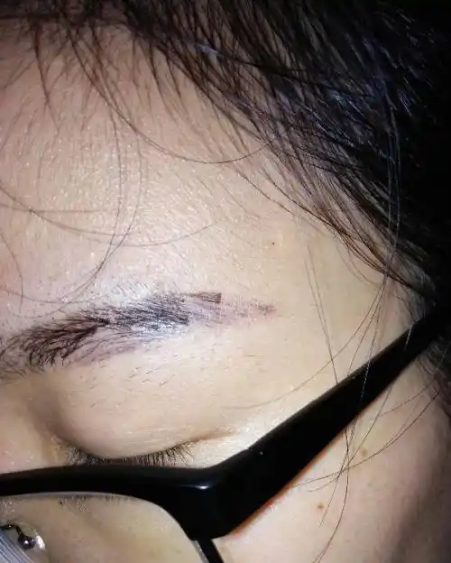 纹眉纹了都七天了,前天开始结咖,结果掉掉咖掉掉得很厉害,一片一片