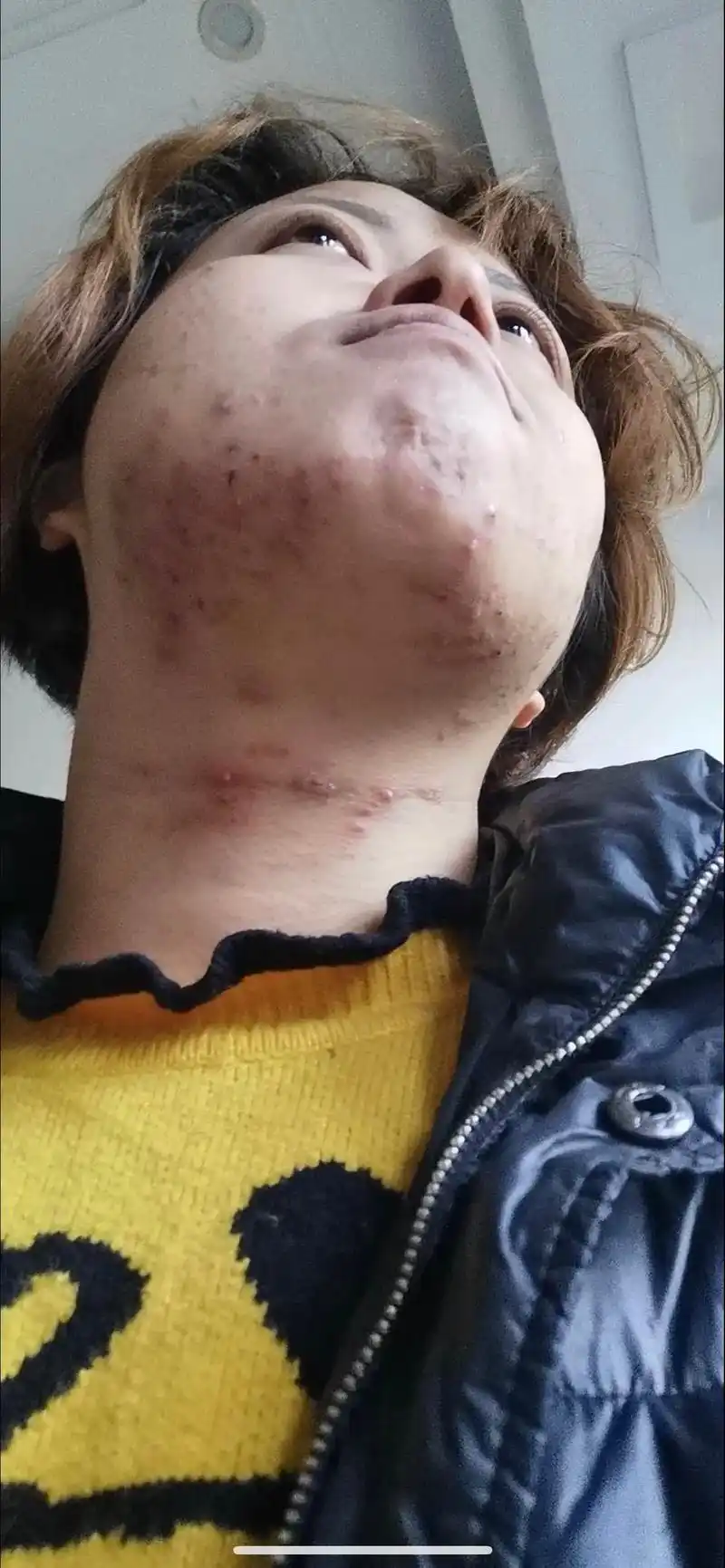 俺家顾客蜕变过程.一技在手,天下我有,踏踏实实拥有一份靠谱的 - 抖音