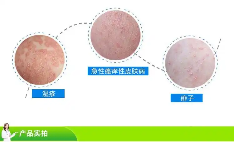 信龙炉甘石洗剂100ml婴儿湿疹皮炎祛痱止痒洗剂1瓶装