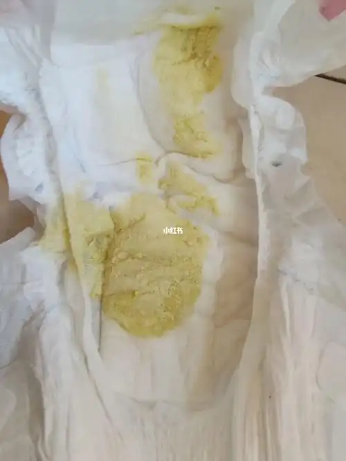 突然拉屎次数增多,是这个浅黄色偏白的,后一次就稀了,有没有知道这是