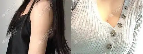 东莞华美自体脂肪丰胸一次能增大几个罩杯能从a杯飞跃到c