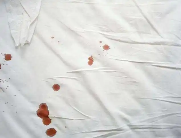 上完厕所看内裤医生3种异常分泌物警惕子宫病变