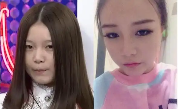 【图】本兮素颜照曝光 妆前妆后吓坏网友