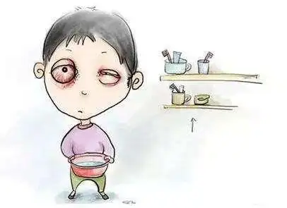 眼睛肿了怎么办快来掌握快速消肿的好办法