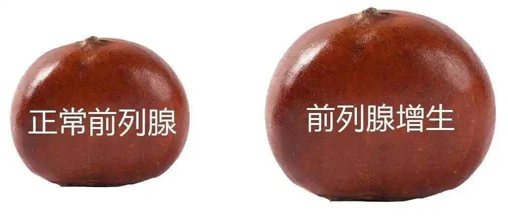 从"呱呱落地"到"耋耄之年",男性要面临哪些健康问题_睾丸_阴茎_阴囊