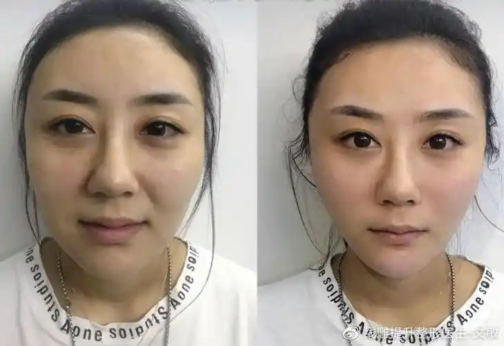 文敏科普同样是做线雕为什么你的效果不如别人好