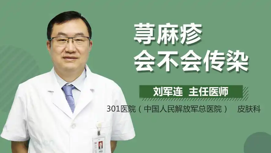 荨麻疹会不会传染