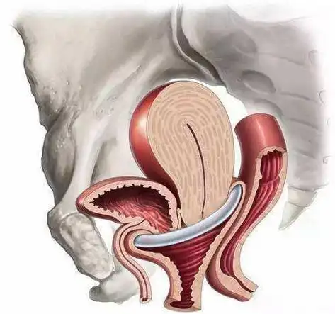子宫脱垂到底是什么?|宫颈|宫体_网易订阅