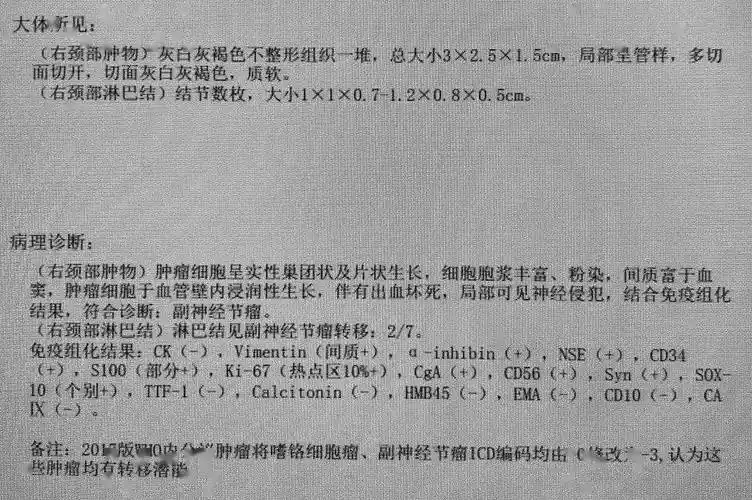 宣武crc星期五丨住院医师笔记:颈动脉体瘤初体验_肿瘤_栓塞_颈部