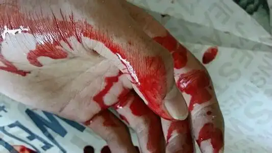 朋友有自残行为,只有我知道,怎么办?