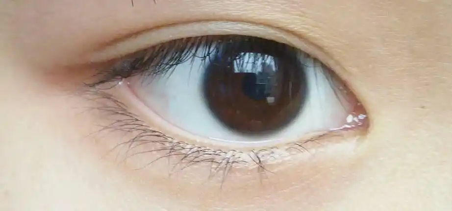 怎样让瞳孔变大,眼睛变黑?我是近视眼