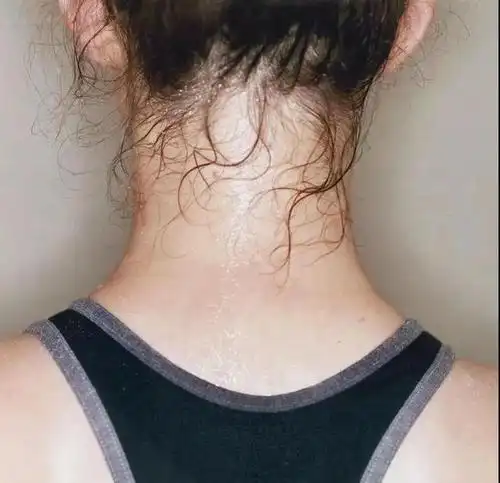 小满养生|运动后大汗淋漓,中医却说这不是好事情!