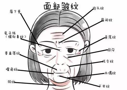 除皱针——皱纹的克星