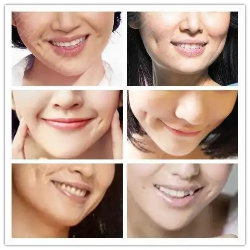 你迷人的小酒窝去哪了?