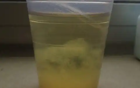 小苏打测男女准确率98,验孕棒验出早和晚的结果和生男生女有关系吗