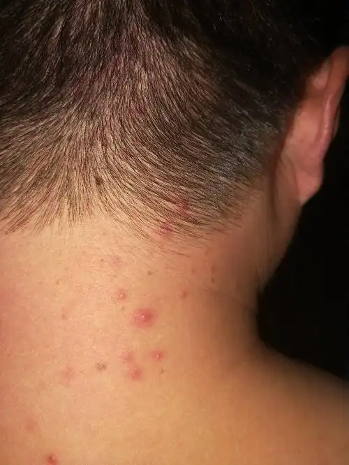 这头上长的什么?