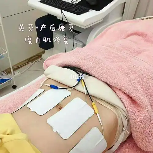 腹直肌修复,技术杠杠哒!