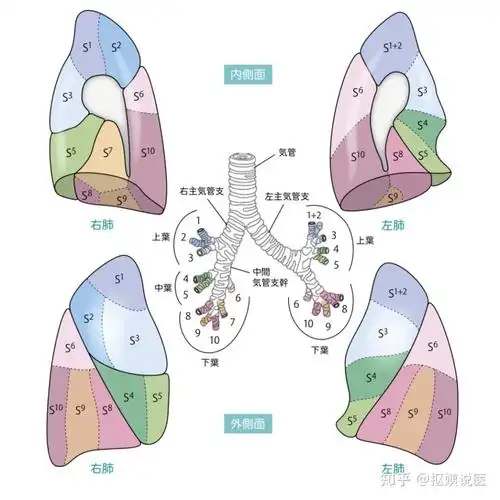 区域支气管的名称与肺区域的名称相对应,根据疾病的不同,显示与肺区域