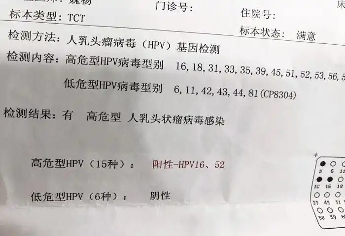 hpv检查阳性是什么意思要治疗吗