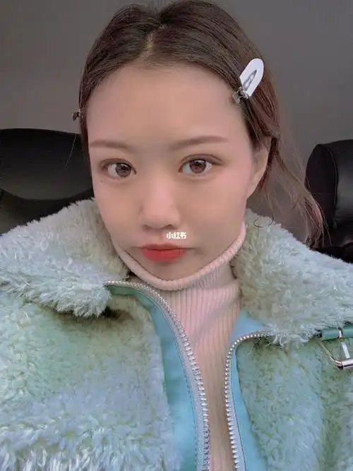 三点定位双眼皮第10天咯～_双眼皮_双眼皮恢复_美妆_医美整形