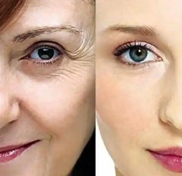 脸上皱纹多能吃盐吗?若想皱纹减少,少吃2种食物,或可以缓解