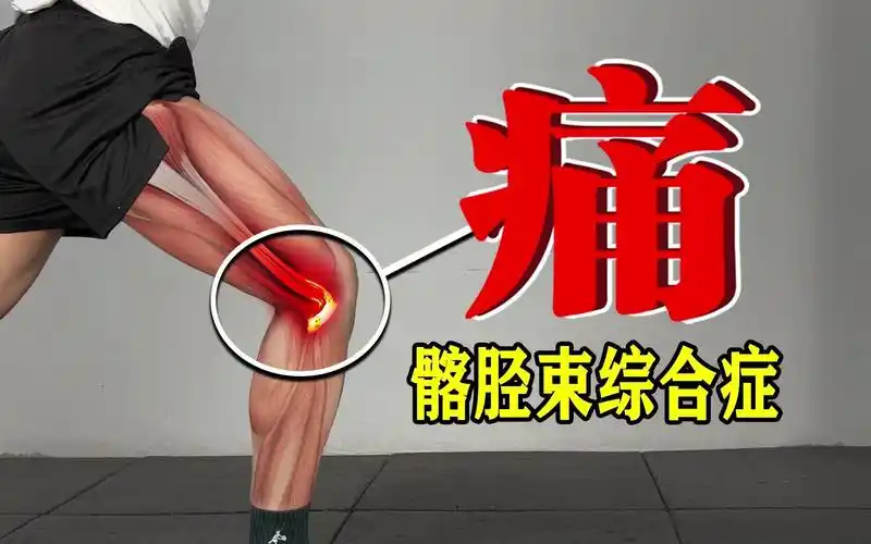 膝盖外侧痛?练这3个动作,根除髂胫束综合症