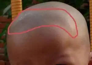 新生儿诞生后,他们的头骨并非先天就是一个整体,而是没有完全闭合的.