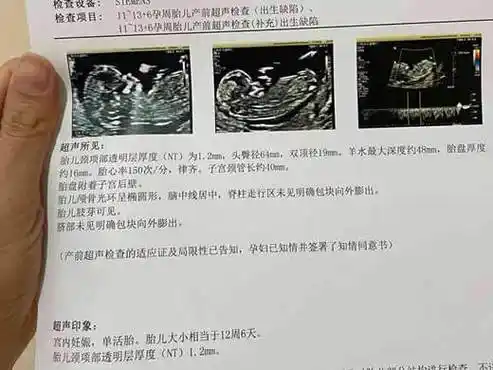 孕13周已生男宝的nt单子特征(数值大于1.5/三个两点)