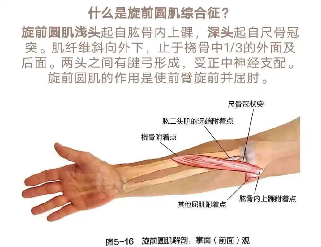 手麻也许是旋前圆肌综合征#日常生活 #针灸推拿  - 抖音