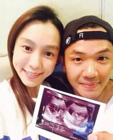 范玮琪怀双胞胎晒b超照